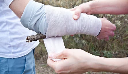 Slideshow Broken Arm 3 445x260 18823 slideshow broken arm 3 445x260