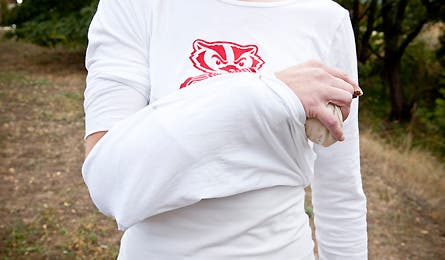 slideshow broken arm 4 445x260