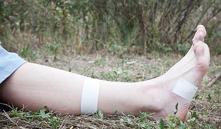 Slideshow Sprained Ankle 2 445x260 18830 slideshow sprained ankle 2 445x260