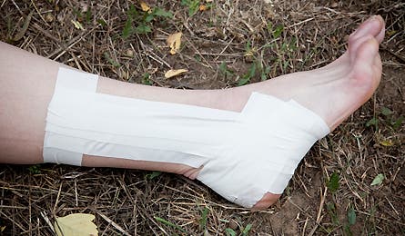 Slideshow Sprained Ankle 5 445x260 18833 slideshow sprained ankle 5 445x260