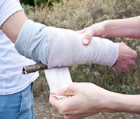 brokenarm_200x170 None