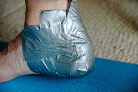 Blister-Taping-(11-of-14).jpg 28227 treat blisters