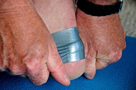 Blister-Taping-(5-of-14).jpg 28221 treat blisters