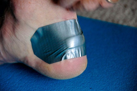 Blister-Taping-(6-of-14).jpg 28222 treat blisters