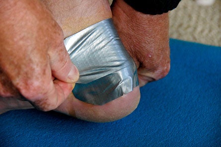 Blister-Taping-(7-of-14).jpg 28223 treat blisters