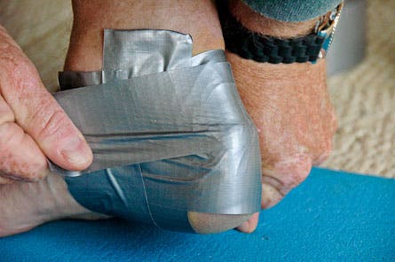 Blister-Taping-(9-of-14).jpg 28225 treat blisters