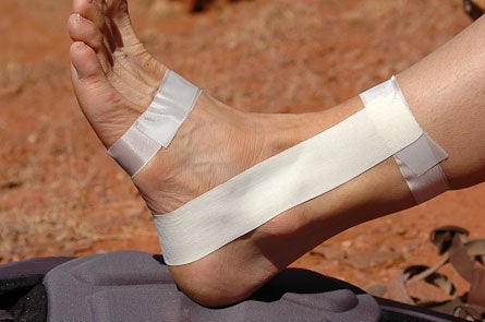 Ankle-Taping-2.jpg 29162 tape a sprained ankle