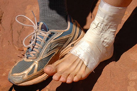 Ankle-Taping-9.jpg 29170 tape a sprained ankle