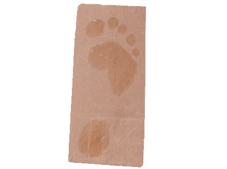 Archtest Supine 445 33104 archtest_supine_445