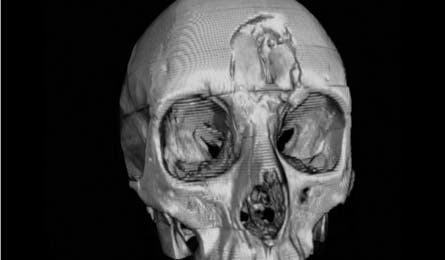 Oct12_Brenna-Skull1_445x260