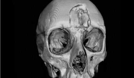 Oct12 Brenna-Skull1 445x260 38455 Oct12_Brenna-Skull1_445x260