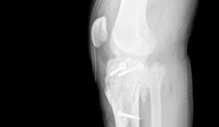 Oct12 Harris Side 445x260 38453 Oct12_Harris_side_445x260