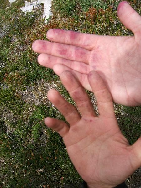 Huckleberry-stained hands None