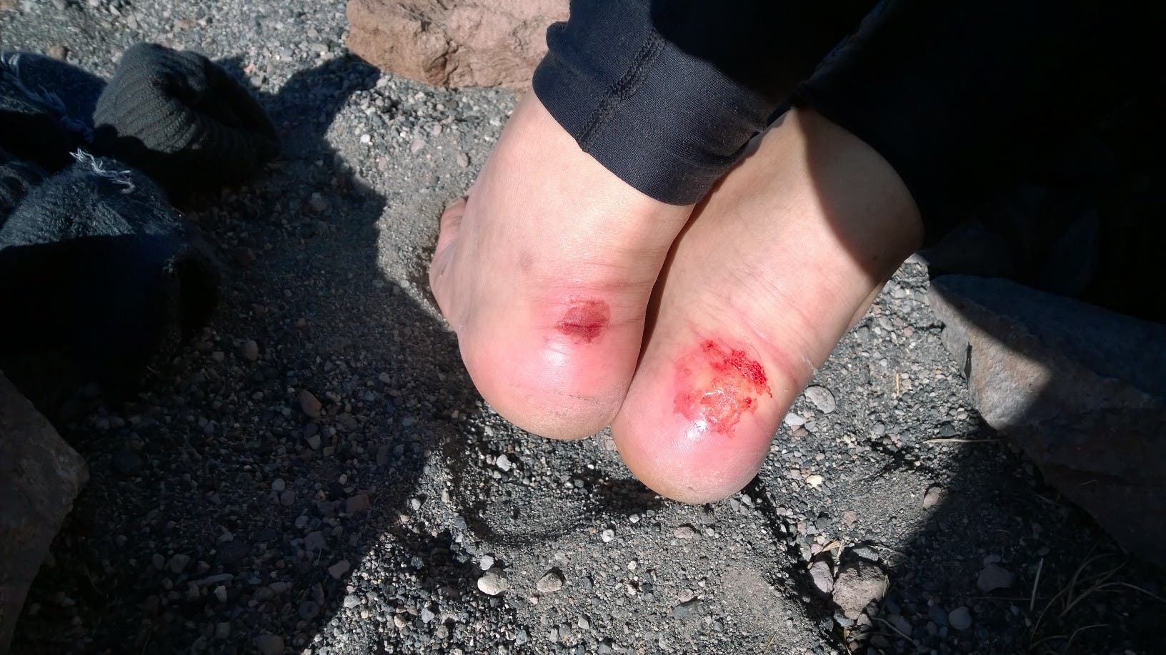 Members of Team 2 arrive in Hidden Valley on Saturday afternoon. Snow school this afternoon, then early to bed before going for the summit early…