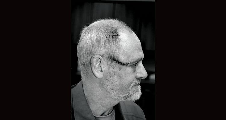 BP0916SURV_OUTALIVE_OPTed4_750x400 mauled