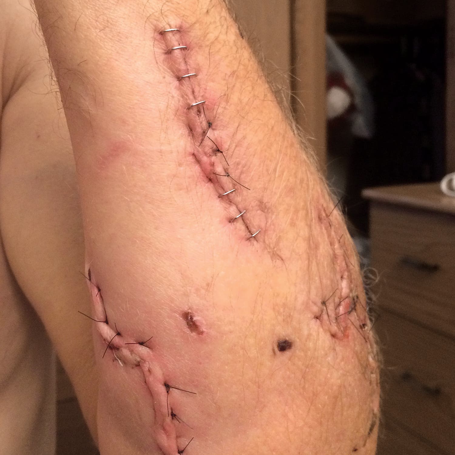 Out alive attacked by a grizzly