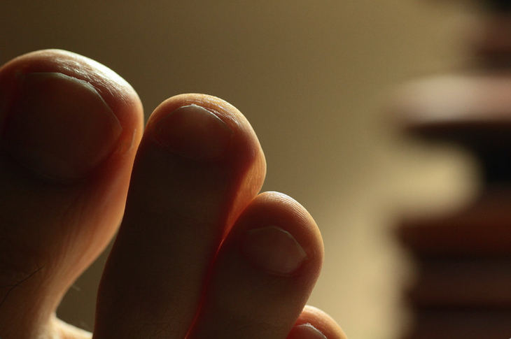screen-shot-2016-04-20-at-9-07-47-am Foot blisters