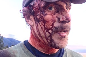Hiker Todd Orr was Mauled by a Grizzly. Twice.