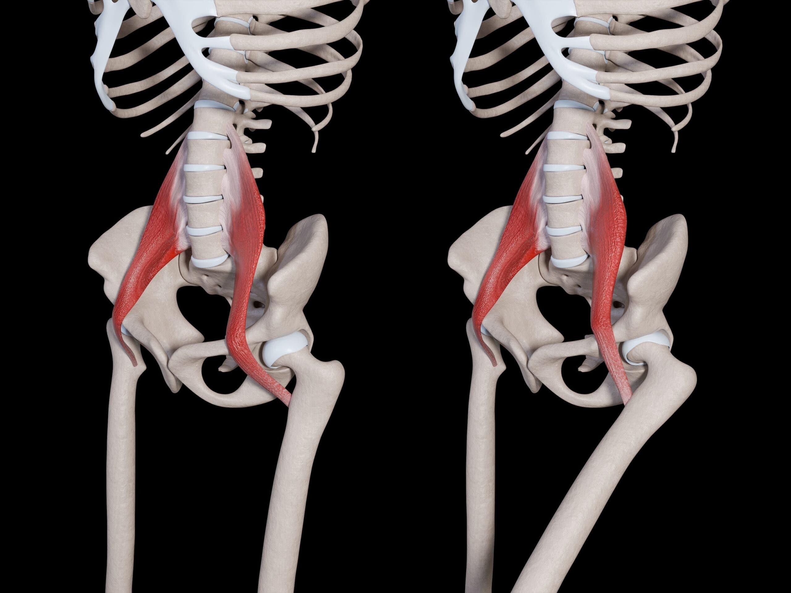 Is Your Psoas Muscle the Root of Your Hip Pain? - Backpacker