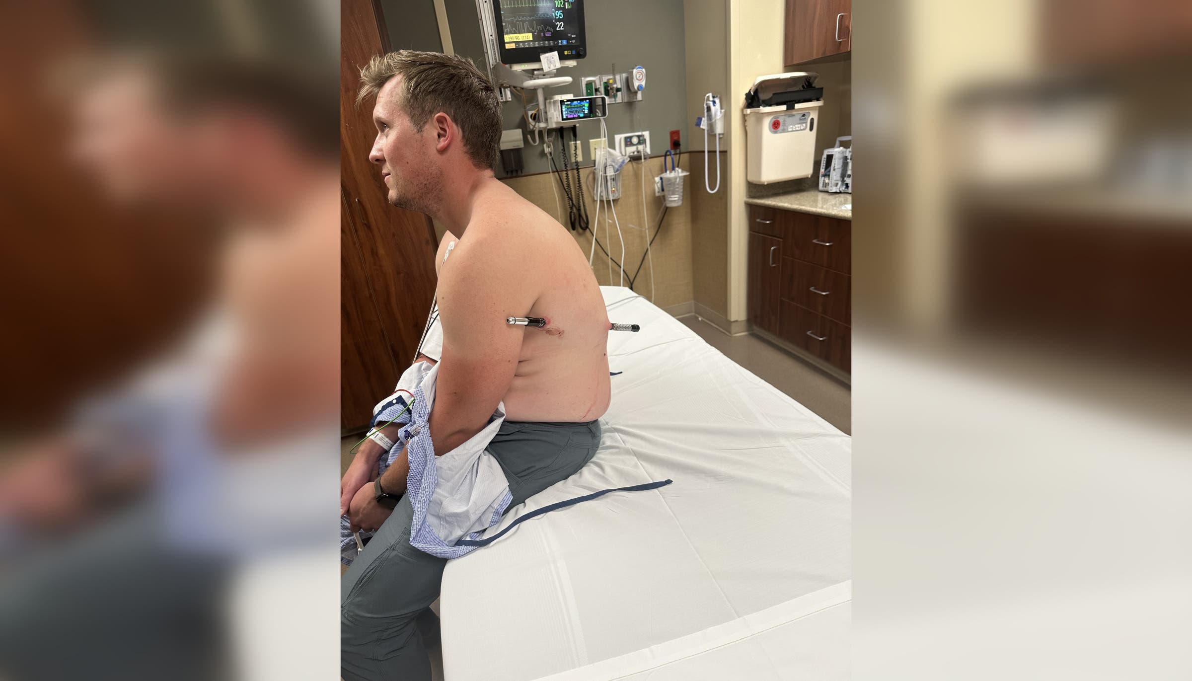 Hiker with trekking poles across body